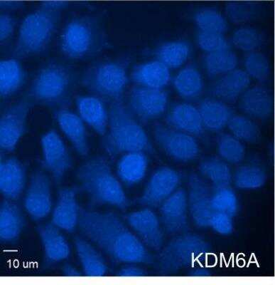 Immunocytochemistry/Immunofluorescence: Goat anti-Mouse IgG1 Heavy Chain Secondary Antibody [DyLight 405] [NB7508V] - Human MCF7 cells was stained with primary KDM6A antibody [H00007403-M05] (1:50), followed by Goat anti-Mouse IgG1 Heavy Chain Secondary Antibody [Dylight 405] (NB7508V, 1:1000). 